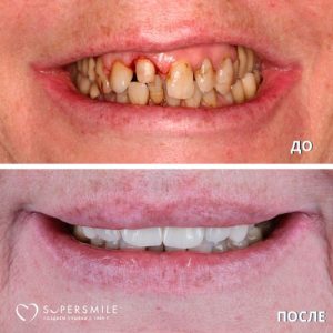 До/После №6801