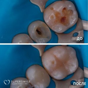 До/После №7930