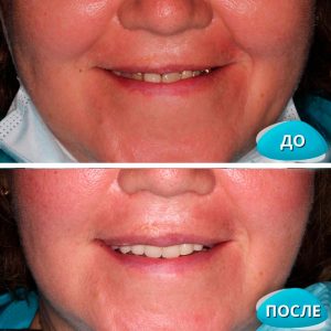 До/После №8218