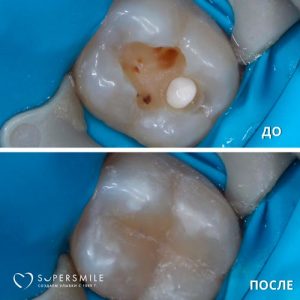 До/После №6519