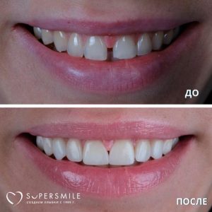 До/После №6800