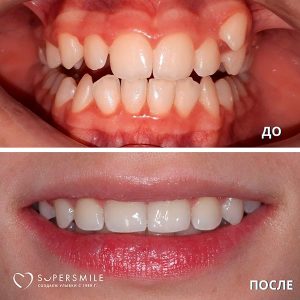 До/После №7350