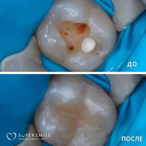 До/После №7896