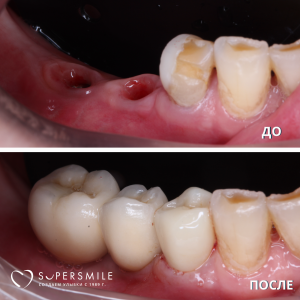 До/После №16178