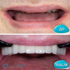 До/После №8219