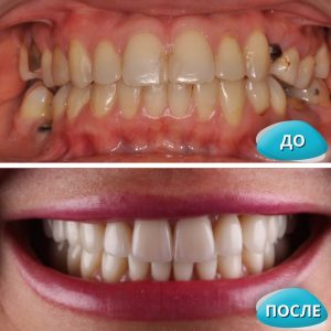 До/После №15467