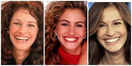 Если такая улыбка выглядит гармонично, ее не нужно исправлять