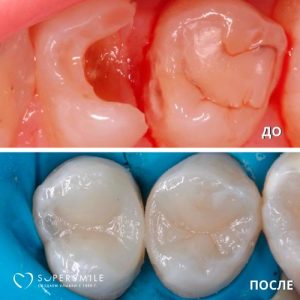 До/После №6518