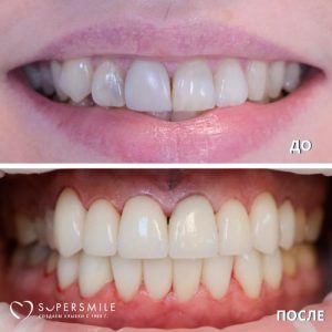 До/После №6799