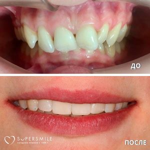 До/После №7351