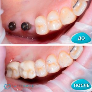 До/После №8220