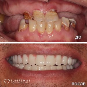 До/После №16179