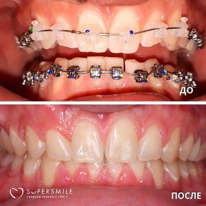 До/После №7352