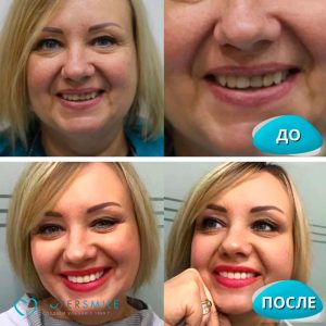 До/После №8221