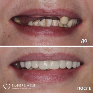 До/После №5770