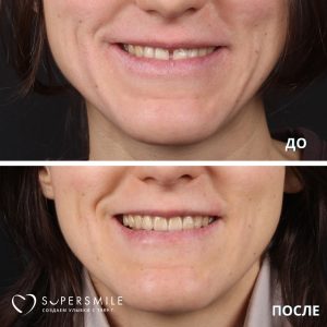 До/После №12726