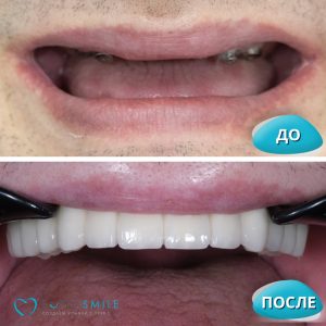 Все на 6 (до/после)