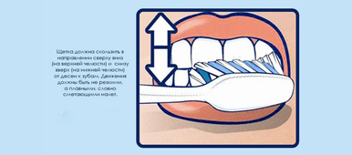 Клиновидный дефект зубов: причины и методы исправления