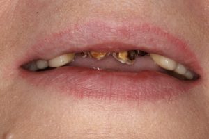 До/После №16003