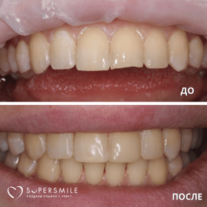 Наши работы №11