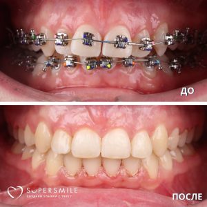 До/После №6146