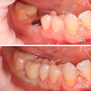 До/После №7470
