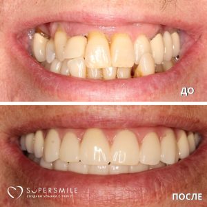 До/После №5774