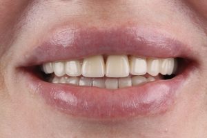 До/После №16005