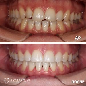 До/После №5286