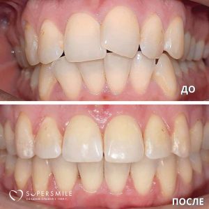 До/После №5288