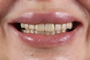 До/После №16004