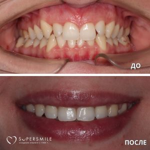 До/После №5289