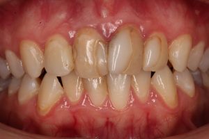 Дистопия (неправильное положение)