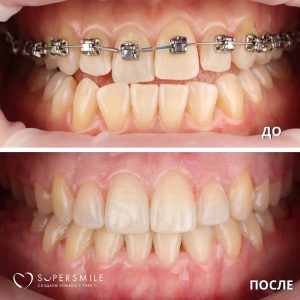 До/После №14231