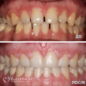 До/После №14228