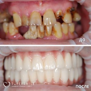 До/После №14304