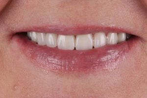 До/После №16007