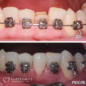 Травма — не приговор для вашей улыбки