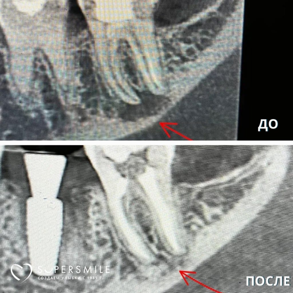 №0