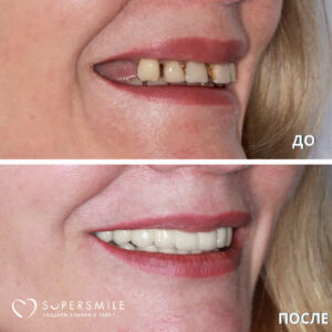 Часто за одной улыбкой стоит большая работа команды врачей