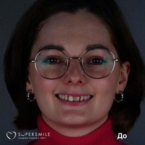 Комплексный план лечения (до/после)