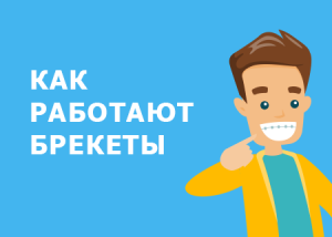 Как работают брекеты?