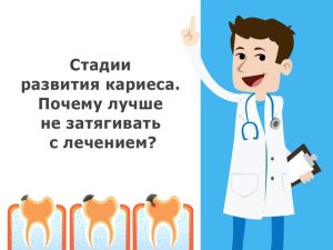 Стадии развития кариеса. Почему лучше не затягивать с лечением?