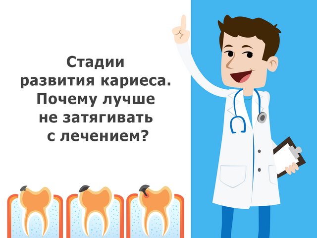 Стадии развития кариеса. Почему лучше не затягивать с лечением?