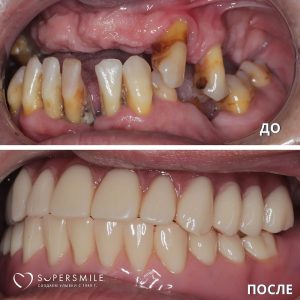 До/После №7151