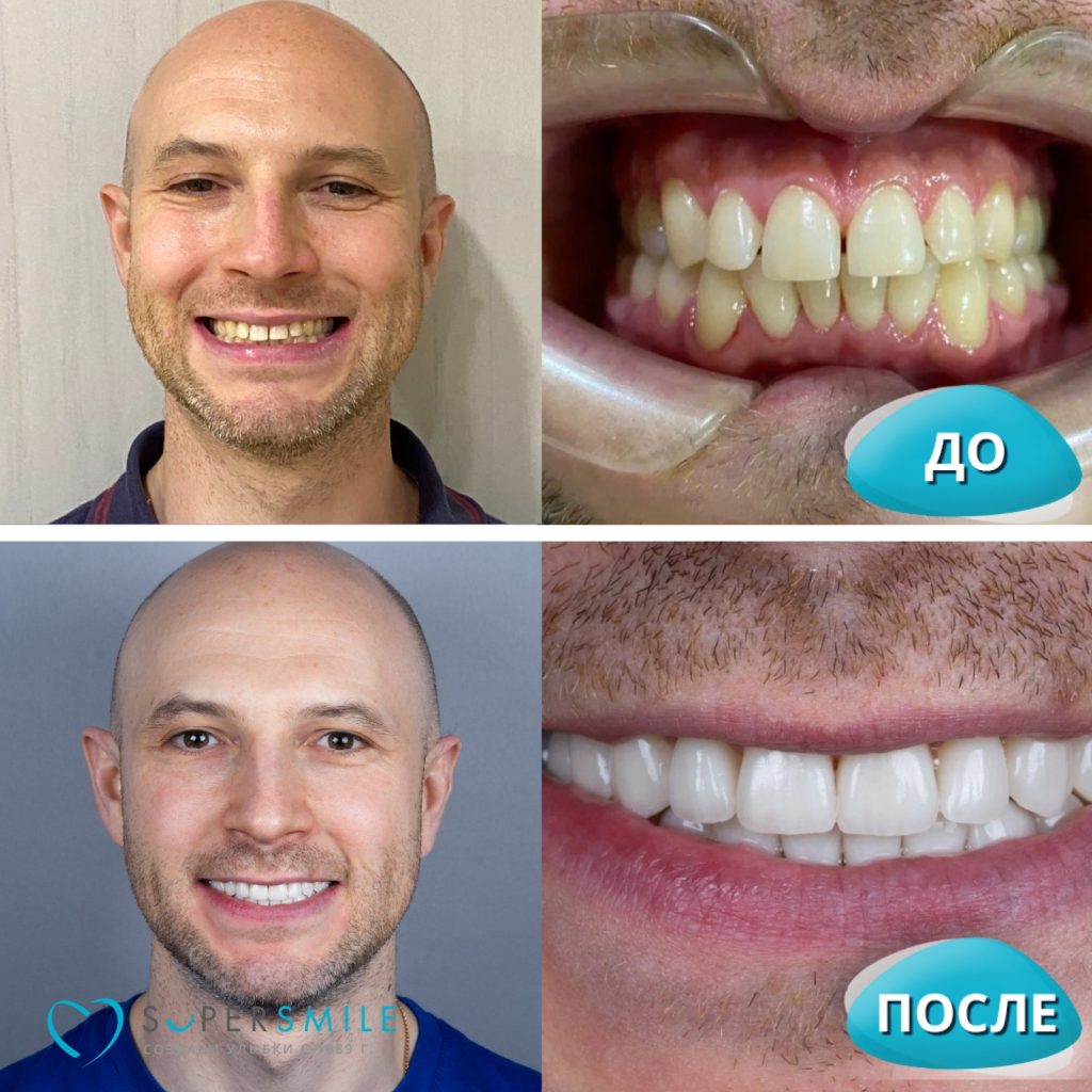 До/После №5059